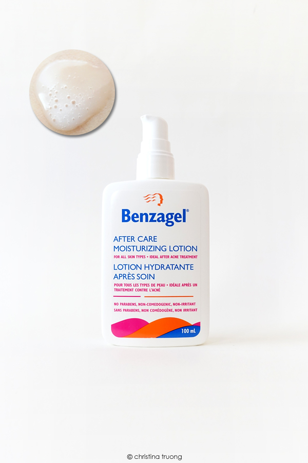 Benzagel After Care Moisturizing Lotion Review